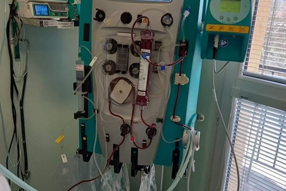 V OBRAZOCH: Zvolenská nemocnica využíva na internej JIS nový prístroj